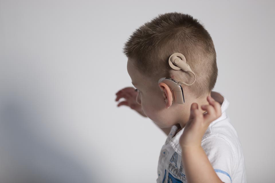 enfant portant un implant cochléaire