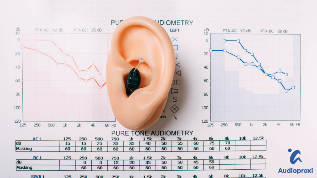 Audiogramme